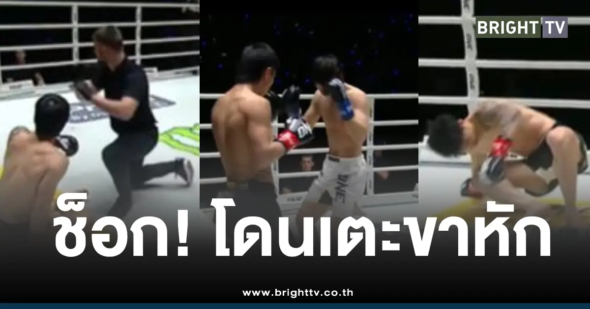 ตะวันฉายขาหักแพ้น็อค