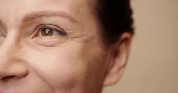 ตาไม่เท่ากัน หลังทำตาสองชั้น เกิดจากอะไร