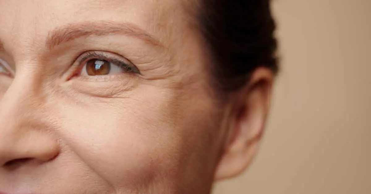 ตาไม่เท่ากัน หลังทำตาสองชั้น เกิดจากอะไร