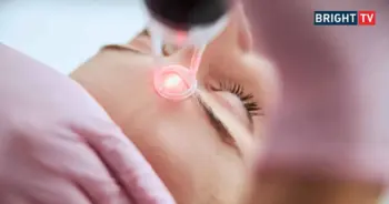Accure Laser