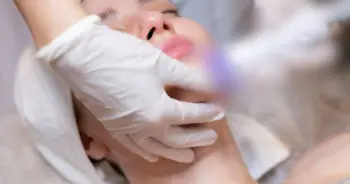V Beam Laser ดีไหม ข้อดี ข้อเสีย และต่างจากเลเซอร์อื่นยังไง (1)