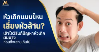 วิธีรักษาหัวเถิก