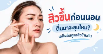 เคล็ดลับดูแลสิวข้ามคืน